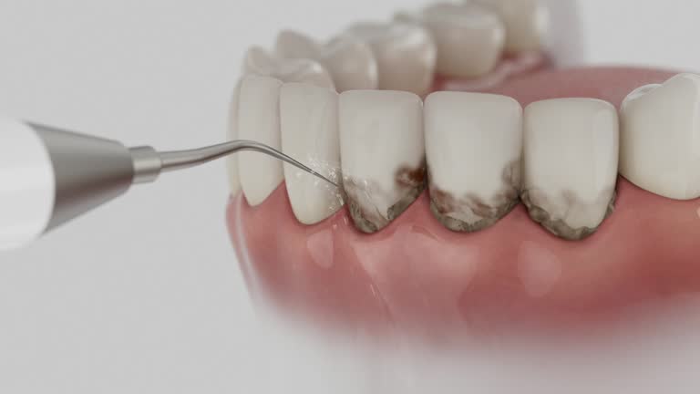 Reliable Tooth Extraction contractor in Perry, OK by Smile Center Dentistry